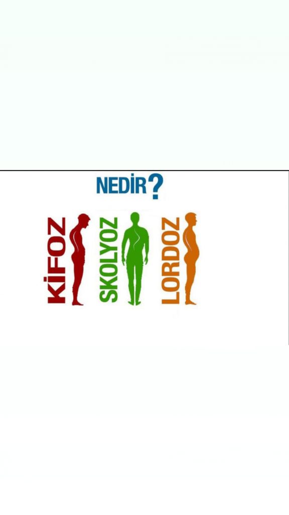 Lordoz nedir?